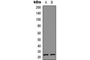 Western blot analysis of IL-17D expression in HeLa (A), Jurkat (B) whole cell lysates. (IL17D anticorps  (C-Term))