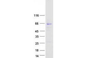 Validation with Western Blot