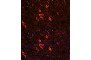 Immunofluorescence analysis of rat brain using EL Rabbit pAb (ABIN6134651, ABIN6140118, ABIN6140119 and ABIN6221704) at dilution of 1:100 (40x lens).