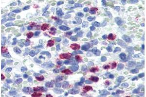 Human Spleen (formalin-fixed, paraffin-embedded) stained with FBXW7 antibody ABIN364303 at 5 ug/ml followed by biotinylated goat anti-rabbit IgG secondary antibody ABIN481713, alkaline phosphatase-streptavidin and chromogen. (FBXW7 anticorps  (Internal Region))