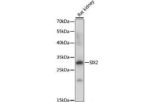 Western blot analysis of extracts of Rat kidney using SIX2 Polyclonal Antibody at dilution of 1:1000. (SIX2 anticorps)