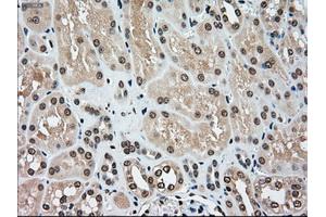 Immunohistochemical staining of paraffin-embedded Kidney tissue using anti-MAP2K4mouse monoclonal antibody. (MAP2K4 anticorps)