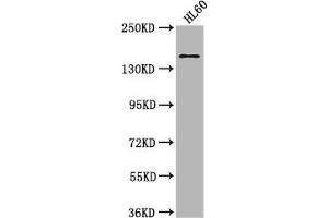 Western Blot Positive WB detected in: HL60 whole cell lysate All lanes: SMARCC2 antibody at 1:2000 Secondary Goat polyclonal to rabbit IgG at 1/50000 dilution Predicted band size: 133, 125, 127 kDa Observed band size: 170 kDa