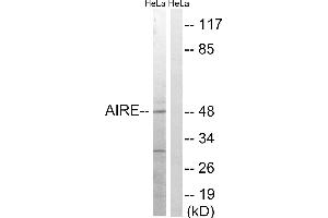 Western blot analysis of extracts from HeLa cells, treated with Hu (2nM, 24hours), using AIRE (Ab-156) antibody. (AIRE anticorps  (Ser156))