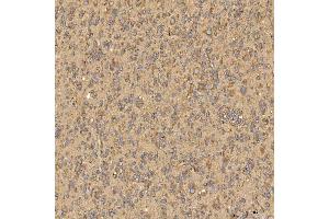 IHC analysis of Citrin/SLC25A13 using anti-Citrin/SLC25A13 antibody (ABIN7599512). (slc25a13 anticorps  (AA 1-643))