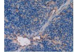 IHC-P analysis of Mouse Spleen Tissue, with DAB staining. (Thrombomodulin anticorps  (AA 31-167))