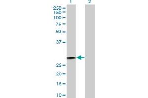 Western Blot analysis of HSD17B10 expression in transfected 293T cell line by HSD17B10 MaxPab polyclonal antibody.