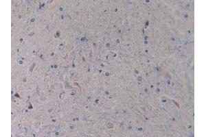 Detection of TLR4 in Rat Spinal cord Tissue using Polyclonal Antibody to Toll Like Receptor 4 (TLR4)