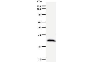 Western Blotting (WB) image for anti-Core-binding Factor, Runt Domain, alpha Subunit 2, Translocated To, 2 (CBFA2T2) antibody (ABIN930909) (CBFA2T2 anticorps)