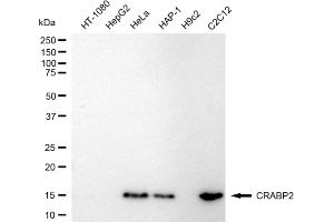 anti-Cellular Retinoic Acid Binding Protein 2 (CRABP2) antibody