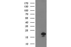 Western Blotting (WB) image for anti-Destrin (Actin Depolymerizing Factor) (DSTN) antibody (ABIN1497908)