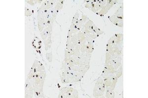 Immunohistochemistry of paraffin-embedded mouse heart using SFPQ antibody.