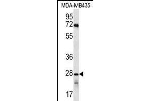 OR10AG1 Antibody (C-term) (ABIN656252 and ABIN2845567) western blot analysis in MDA-M cell line lysates (35 μg/lane). (OR10AG1 anticorps  (C-Term))