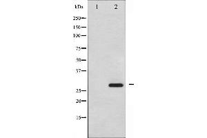 Western blot analysis of HSP27 phosphorylation expression in UV treated HeLa whole cell lysates,The lane on the left is treated with the antigen-specific peptide. (HSP27 anticorps  (pSer15))