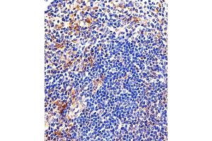 Immunohistochemical analysis of paraffin-embedded M. (LYN anticorps  (AA 229-263))
