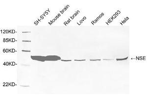 Western blot analysis of tissue and cell lysates using 1 µg/mL Rabbit Anti-NSE Polyclonal Antibody (ABIN398881) The signal was developed with IRDye TM800 Conjugated Goat Anti-Rabbit IgG. (ENO2/NSE anticorps  (C-Term))
