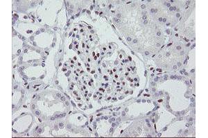 Image no. 1 for anti-Meis Homeobox 3 (MEIS3) (AA 1-261) antibody (ABIN1490670) (MEIS3 anticorps  (AA 1-261))