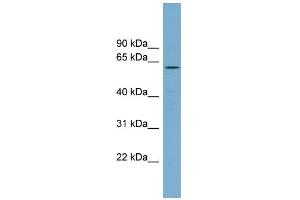 WB Suggested Anti-RIOK2 Antibody Titration: 0. (RIOK2 anticorps  (Middle Region))