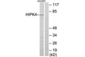 Western blot analysis of extracts from HuvEc cells, using HIPK4 Antibody.