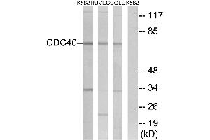 Western blot analysis of extracts from K562 cells, HUVEC cells and COLO cells, using CDC40 antibody. (CDC40 anticorps  (Internal Region))