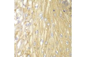 Immunohistochemistry of paraffin-embedded human esophageal using PPP2R2A antibody at dilution of 1:100 (400x lens). (PPP2R2A anticorps)