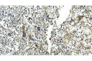 IHC analysis of CDC123 using anti-CDC123 antibody (ABIN7599284). (CDC123 anticorps  (AA 1-336))