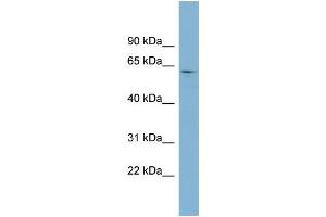 WB Suggested Anti-EPB41 Antibody Titration:  0. (EPB41 anticorps  (Middle Region))