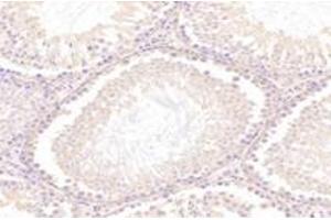 Immunohistochemistry analysis of paraffin-embedded rat testis using,NT5C1B (ABIN7072861) at dilution of 1: 1200