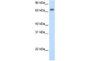 WB Suggested Anti-Mta2 Antibody Titration:  0. (MTA2 anticorps  (N-Term))