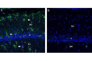 Expression of C5aR2 in rat hippocampus.