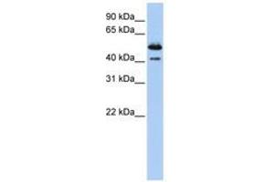 Image no. 1 for anti-Deoxyribonuclease II beta (DNASE2B) (AA 288-337) antibody (ABIN6740777) (DNASE2B anticorps  (AA 288-337))