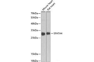 Western blot analysis of extracts of various cell lines using SPATA4 Polyclonal Antibody at dilution of 1:1000. (SPATA4 anticorps)