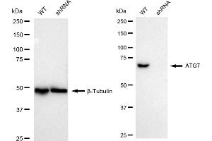 Western blotting analysis using ATG7 antibody (ABIN7797676).