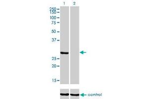 Western blot analysis of KHK over-expressed 293 cell line, cotransfected with KHK Validated Chimera RNAi (Lane 2) or non-transfected control (Lane 1).