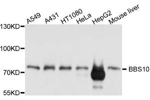 Western blot analysis of extract of various cells, using BBS10 antibody. (BBS10 anticorps)