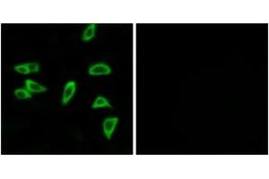 Immunofluorescence analysis of LOVO cells, using PTGER3 Antibody. (PTGER3 anticorps  (AA 16-65))
