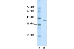 WB Suggested Anti-ZBTB26 Antibody Titration:  0. (ZBTB26 anticorps  (Middle Region))