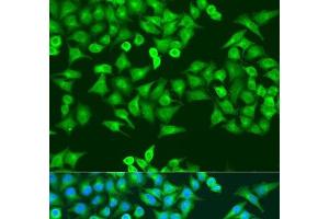 Immunofluorescence analysis of U2OS cells using RRM1 Polyclonal Antibody at dilution of 1:100. (RRM1 anticorps)