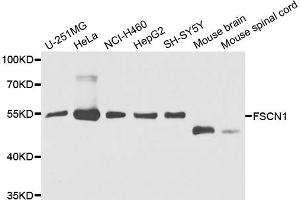 Western blot analysis of extracts of various cell lines, using FSCN1 antibody (ABIN5975344) at 1/1000 dilution. (Fascin anticorps)