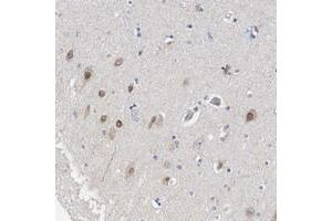 Immunohistochemical staining of human hippocampus with LRCH1 polyclonal antibody  shows distinct nuclear positivity in neuronal cells at 1:200-1:500 dilution. (LRCH1 anticorps)