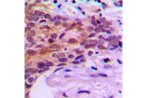 anti-MOB Kinase Activator 1B (MOB1B) (Center) antibody