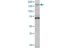LMTK3 monoclonal antibody (M02A), clone 2H6 Western Blot analysis of LMTK3 expression in Hela S3 NE . (LMTK3 anticorps  (AA 1151-1250))