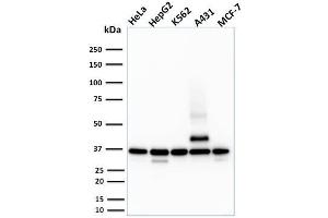 Western Blot Analysis of HeLa, HepG2, K562, A431 and MCF-7 cell lysate using RAD51 Mouse Monoclonal Antibody (RAD51/2701). (RAD51 anticorps  (AA 1-134))
