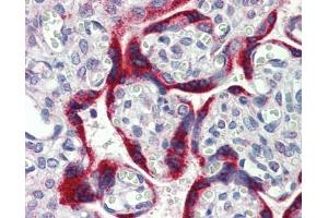 MKNK2 antibody was used for immunohistochemistry at a concentration of 4-8 ug/ml.