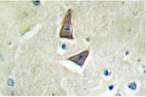 Immunohistochemical analysis using CD4 antibody in Paraffin-embedded human brain tissue. (CD4 anticorps)