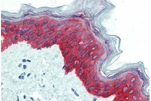 Skin, Human: Formalin-Fixed, Paraffin-Embedded (FFPE) (KRT14 anticorps  (C-Term))