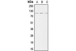 Western blot analysis of ACTN2 expression in HeLa (A), mouse kidney (B), H9C2 (C) whole cell lysates. (ACTN2 anticorps  (N-Term))
