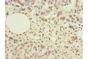 Immunohistochemistry of paraffin-embedded human adrenal gland tissue using ABIN7169283 at dilution of 1:100