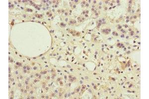 Immunohistochemistry of paraffin-embedded human adrenal gland tissue using ABIN7169283 at dilution of 1:100 (PPP2R3B anticorps  (Regulatory Subunit B))