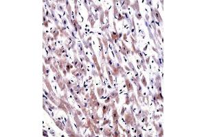 Immunohistochemistry (IHC) image for anti-Egl-9 Family Hypoxia Inducible Factor 3 (EGLN3) antibody (ABIN2997822)